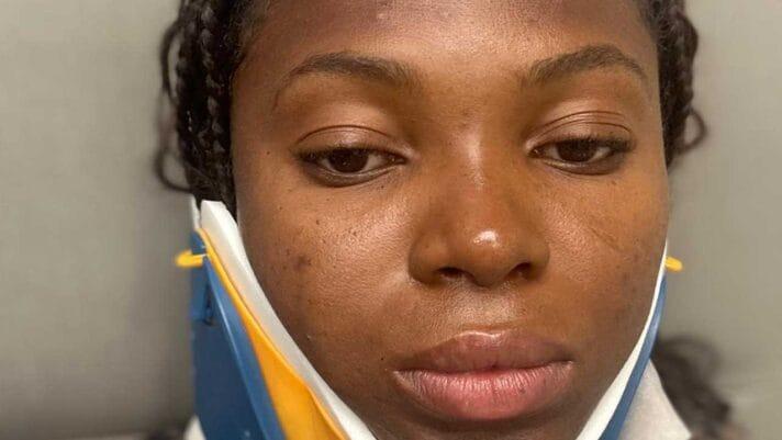 AFN sympathizes with Ese Brume after car&nbsp;crash